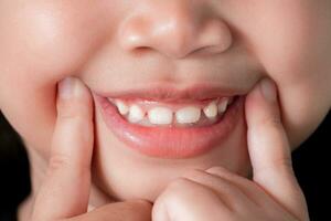 fermer de une mignonne asiatique fille montrer du doigt sa doigt à le coin de sa bouche et souriant Heureusement montrant sa de face dents. content la vie concept photo