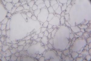 coupe d'agaricus au microscope