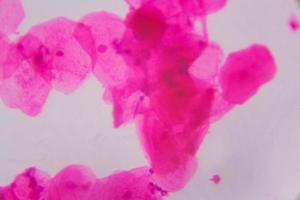 épithélium pavimenteux multiple au microscope - points roses abstraits sur fond blanc