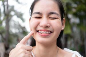 portrait de une Jeune asiatique femme avec un appareil dentaire sur sa les dents photo