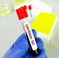 du sang échantillon pour Lyme maladie essai. photo