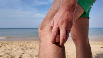 amateur de plage embrayages jambe dans douleur, bord de mer, plage mouche morsures, plage Puce mord photo