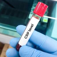 du sang échantillon pour CRP ou c réactif protéine tester utilisé à identifier inflammation ou infection dans le corps photo