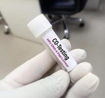 vaginal fluide échantillon pour co-test ou hpv ADN tester et lbc test, Humain papillome virus, cervical cancer. une médical essai concept dans le laboratoire photo