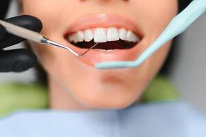 magnifique sourire avec blanc dents. fermer de souriant femme bouche avec Naturel dodu plein lèvres et en bonne santé parfait sourire photo