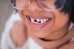 détail coup de enfant avec les dents disparu photo