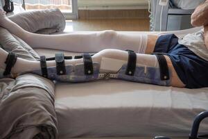 une homme avec une cassé jambe dans un orthèse sur une lit dans une clinique après un accident et une fracture de le fémur photo