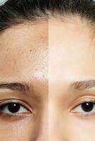 avant et après cosmétique opération. photo