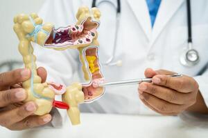 intestin, appendice et digestif système, médecin en portant anatomie modèle pour étude diagnostic et traitement dans hôpital. photo