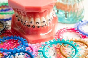 orthodontique ligatures anneaux et cravates, élastique caoutchouc bandes sur orthodontique croisillons, modèle pour dentiste en train d'étudier à propos dentisterie. photo