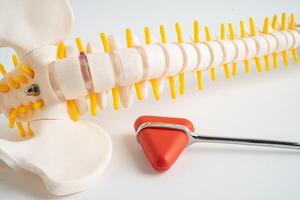 Humain spinal nerf et OS avec percussion réflexe marteau, modèle pour traitement médical dans le orthopédique département. photo