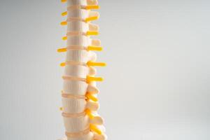 lombaire colonne vertébrale déplacé hernie disque fragment, spinal nerf et os. modèle pour traitement médical dans le orthopédique département. photo