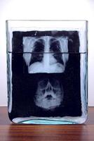 radiographie résultats film de Humain crâne radiographie balayage dans verre laboratoire navire avec liquide photo