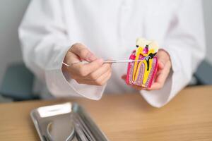 dentiste avec dent anatomie modèle. oral les dents pourriture et maladie, rayer de tartre. Mars oral santé, dentiste jour, faux dents. mal aux dents et les enfants dentaire santé mois et orthodontique santé journée photo