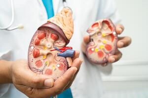 un rein maladie, chronique un rein maladie ccd, médecin tenir modèle à étude et traiter dans hôpital. photo