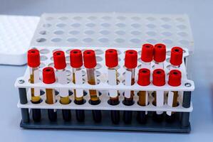 grille de du sang tubes tester pour une analyse dans le laboratoire de hématologie. pneumonie diagnostiquer. covid-19 et coronavirus identification. pandémie. photo
