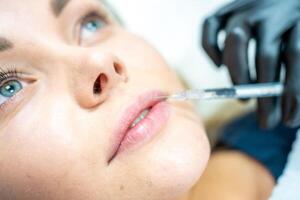 fermer de femme visage et main dans chirurgical gant en portant seringue près sa lèvres, prêt à recevoir beauté traitement. injection cosmétologie, lèvres augmentation et correction concept. photo