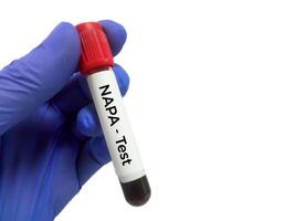 du sang échantillon pour n-acétylprocaïnamide ou Napa photo