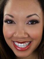 serré portrait de souriant noir femme avec un appareil dentaire photo