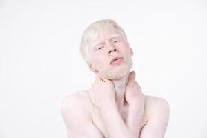 portrait de un albinos homme dans studio habillé T-shirt isolé sur une blanc Contexte. anormal déviations. inhabituel apparence photo