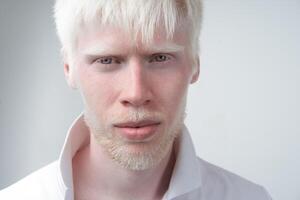 portrait de un albinos homme dans studio habillé T-shirt isolé sur une blanc Contexte. anormal déviations. inhabituel apparence photo