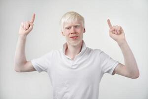 albinisme albinos homme dans studio habillé T-shirt isolé sur une blanc Contexte. anormal déviations. inhabituel apparence photo