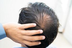 chauve au milieu de la tête et ne commence pas à perdre les cheveux glabres d'un homme de bureau actif et intelligent d'affaires asiatiques matures. photo