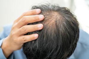 chauve au milieu de la tête et ne commence pas à perdre les cheveux glabres d'un homme de bureau actif et intelligent d'affaires asiatiques matures. photo