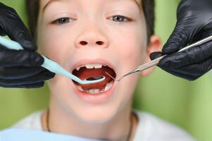 mignonne garçon souriant tandis que les dents examen . content garçon séance dans dentistes chaise et ayant vérifier en haut les dents photo