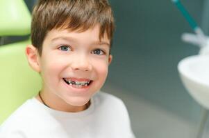 le garçon inserts un orthodontique assiette dans le sien bouche photo