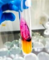 salmonelle détection méthode par en utilisant tripler sucre le fer ou tsi gélose dans microbiologie laboratoire. photo