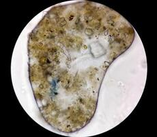 schistosome parasite ovules dans Humain urine spécimen en dessous de microscope. urinaire parasite photo