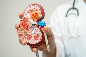 un rein maladie, chronique un rein maladie ccd, médecin avec Humain modèle à étude et traiter dans hôpital. photo