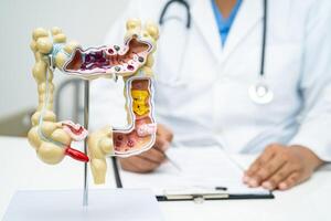 intestin, appendice et digestif système, médecin en portant anatomie modèle pour étude diagnostic et traitement dans hôpital. photo