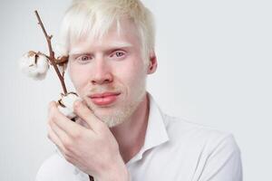 albinisme albinos homme dans studio habillé T-shirt isolé sur une blanc Contexte. anormal déviations. inhabituel apparence photo