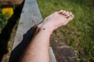 le insecte mord le Humain jambe, le aveugle homme est assis sur le peau, le mordre de une nocif reptile, le mouche rampe sur le jambe, partie de le corps, orteils. photo