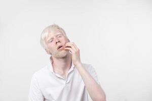 portrait de un albinos homme dans studio habillé T-shirt isolé sur une blanc Contexte. anormal déviations. inhabituel apparence photo