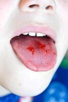 fermer de lèvres, langue, saillie de sang. enfant mordu langue. photo
