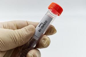 tube à essai avec étiquette covid19. matériel de laboratoire de microbiologie. coronavirus, test covid 19 photo