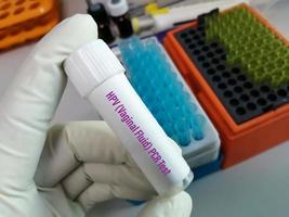 scientifique tenant un conteneur d'échantillon avec un échantillon de liquide cervical pour le test d'adn pcr hpv, virus du papillome humain, cancer du col de l'utérus. un concept de test médical en laboratoire photo