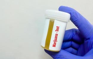 récipient d'urine de laboratoire médical avec échantillon d'urine pour test de drogue cocaïne. diagnostic de drogue illégale cocaïne dans l'urine. photo