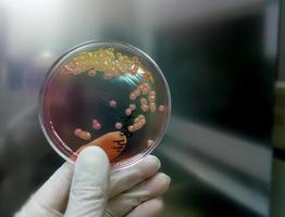 colonie de bactéries dans une plaque de milieu de culture. coproculture, e.coli photo