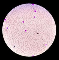 vue microscopique d'une lame d'hématologie. vue rapprochée. photo