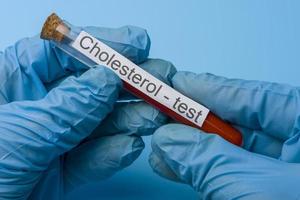 main tenant un test de cholestérol dans un tube à essai sur fond bleu. photo