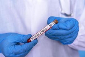 les mains dans des gants médicaux tiennent une fiole de sang pour un test de testostérone. photo
