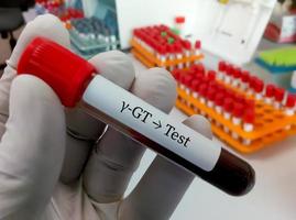 échantillon de sang pour test gamma gt ou gamma-glutamyl transférase, enzyme hépatique photo