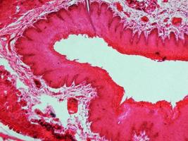 micrographie des cellules de l'épithélium photo