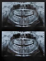 radiographie des dents du visage entier photo