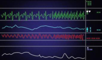 moniteur patient montrant les signes vitaux ecg et ekg. illustration vectorielle. photo