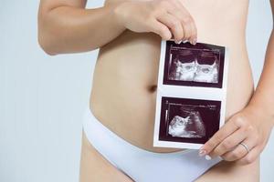 femme enceinte tenant une image échographique concept de grossesse photo